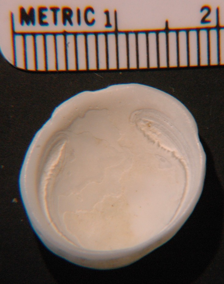 hipponix cranioides anterior